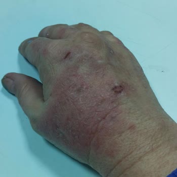 Fairy Deterjanı Ellerimde Sorun Yarattı