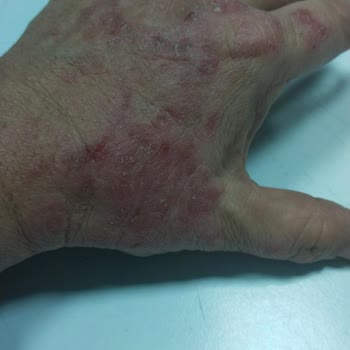 Fairy Deterjanı Ellerimde Sorun Yarattı