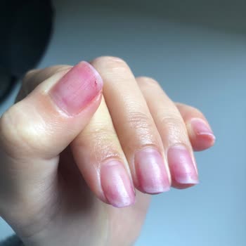 Kalıcı Oje Çıkarma İşleminde Tırnak Hasarı