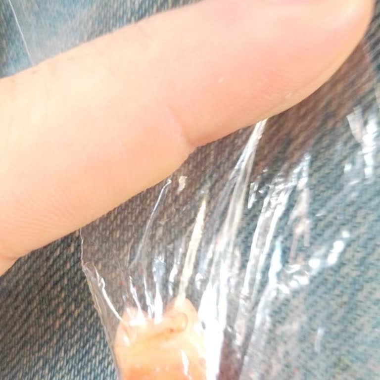 Yanlış Diş Çekimi Mağduriyeti