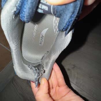 Skechers Ayakkabı Garanti Sorunu Ve Müşteri Memnuniyetsizliği