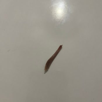 Tehlikeli Tavuk Kemiği: İnsan Hayatını Tehlikeye Atan Dikkatsizlik