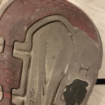 Skechers Ayakkabımın Erken Yıpranması Ve Boyner'in Yetersiz Çözüm Süreci