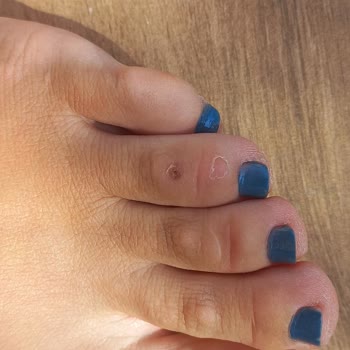 Aldo Shoes from Mall of Istanbul Caused Severe Foot Injuries, Return Denied
