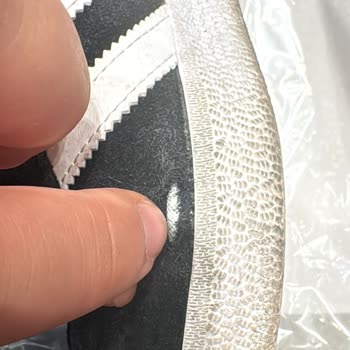 Sneaks Up Adidas Gazelle Ayakkabıda Kalite Sorunu Ve İade Problemi!