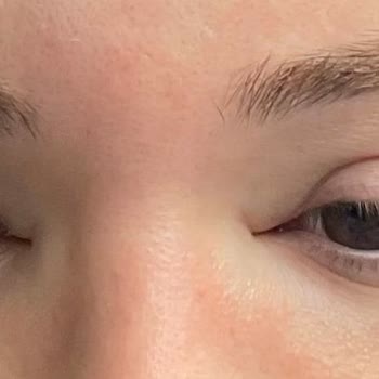 Kına Gecesinde Sağlık Sorunları Ve İlgisizlik