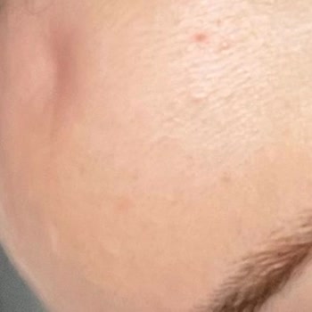 Kına Gecesinde Sağlık Sorunları Ve İlgisizlik