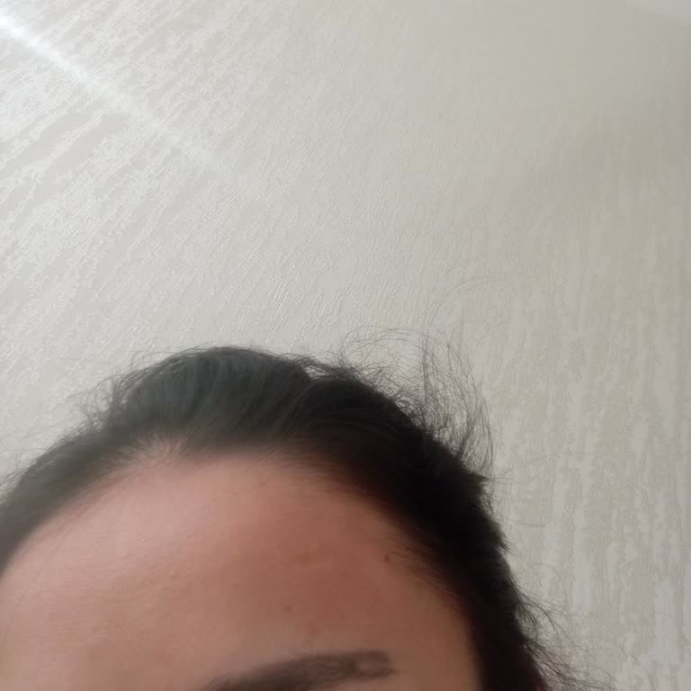 Diyarbakır Sümeyye Demir Güzellik Merkezi Microblading Sıkıntısı