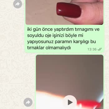 Kalıcı Oje Kabusu: Soyulan Tırnaklar