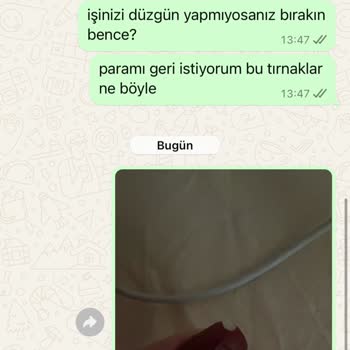 Kalıcı Oje Kabusu: Soyulan Tırnaklar