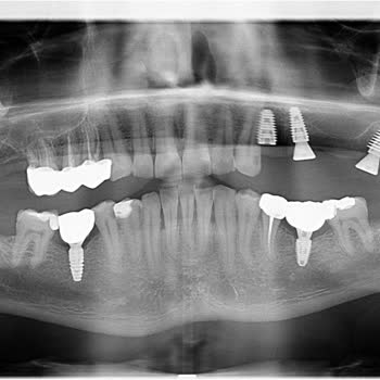 Diş Kliniği Mağduriyeti Ve Hakem Heyeti Kararı Sorunu