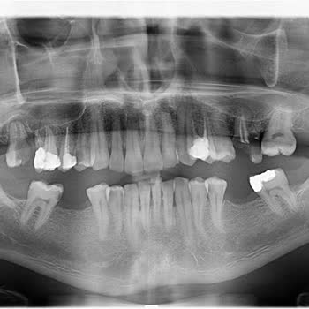 Diş Kliniği Mağduriyeti Ve Hakem Heyeti Kararı Sorunu