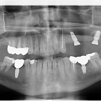 Diş Kliniği Mağduriyeti Ve Hakem Heyeti Kararı Sorunu