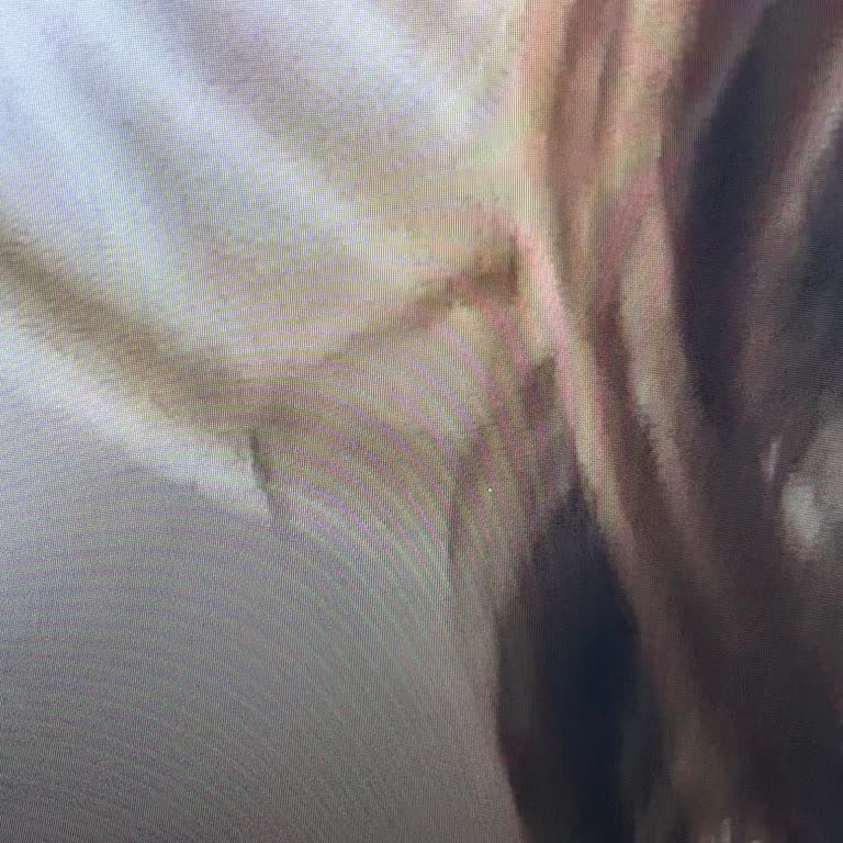 LG Televizyonunda Piksel Sorunu Ve Müşteri Hizmetleri İlgisizliği