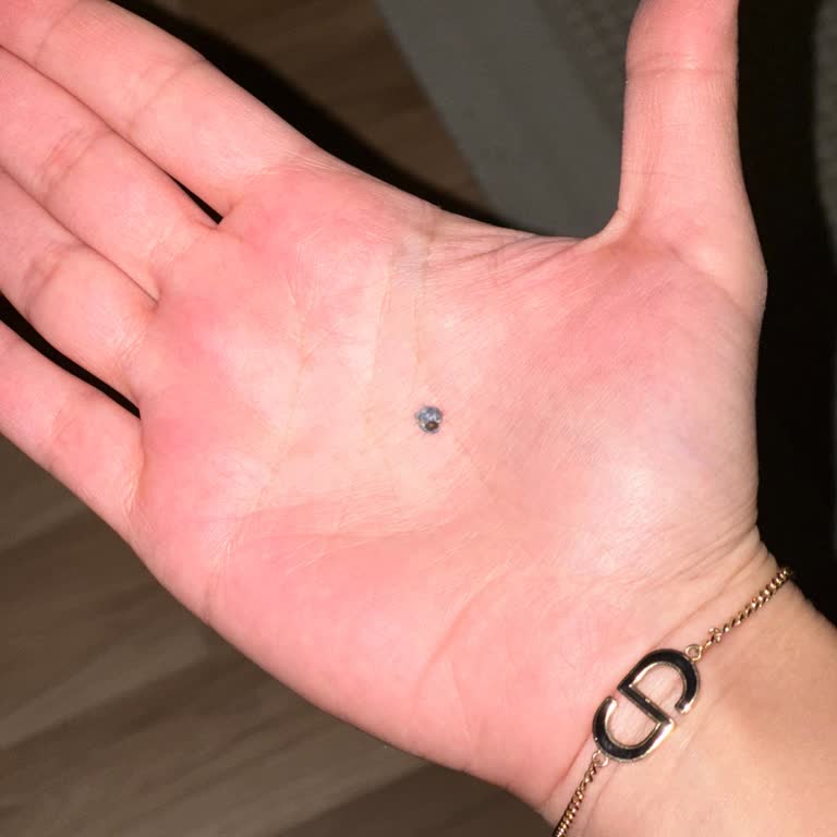 Yanlış Teşhis Ve Yetersiz Muayene