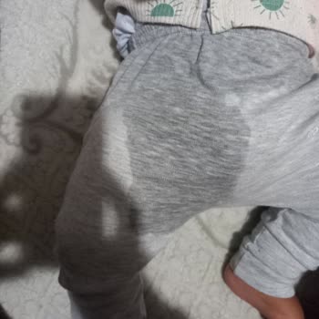 Goo. N Friend Bezlerinde Sızdırma Sorunu