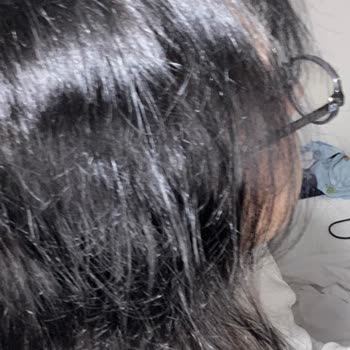 Yanlış Renk Boya Mağduriyeti: Saçlarım Siyah Oldu!