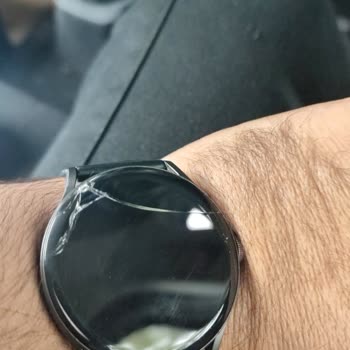 Xiaomi Akıllı Saat Tamir Ücreti Şok Etti