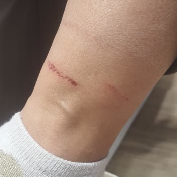 Deichmann Botları Bileklerimi Yaraladı!