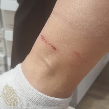 Deichmann Botları Bileklerimi Yaraladı!