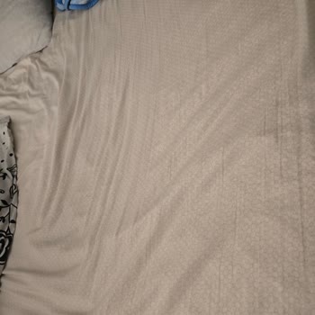 Yatsan Yatakta Çukurlaşma Ve Servis Sorunu