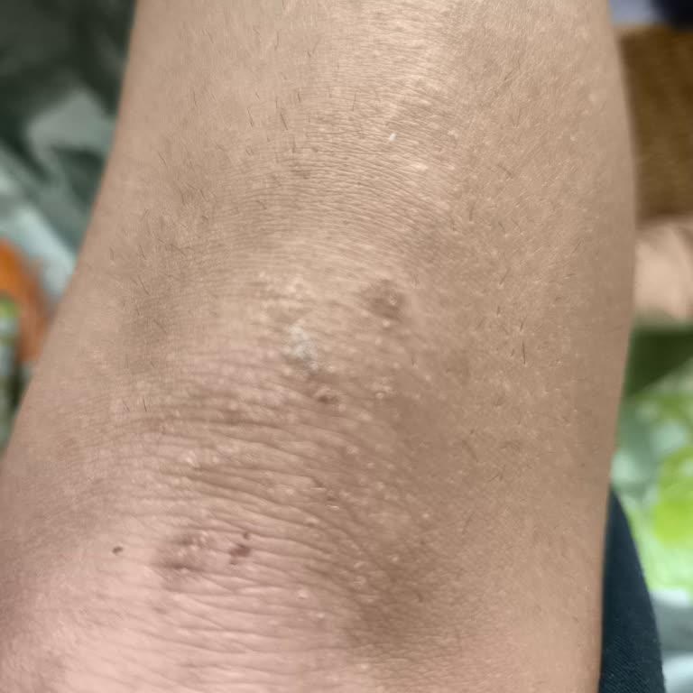 Rönesans Vip Güzellik Salonu Lazer Epilasyon Deneyiminde Hayal Kırıklığı!