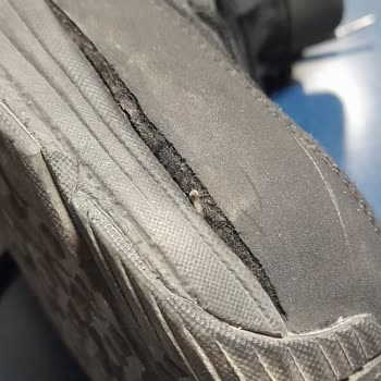 Skechers Bot İlgisizliği: Tüketici Hakları Mücadelesi