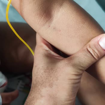 Yoğun Bakımda Yetersiz Hizmet Ve İletişim Sorunları