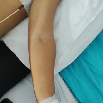 Yoğun Bakımda Yetersiz Hizmet Ve İletişim Sorunları