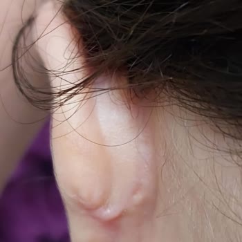 Özel Ekol Hastanesi (Edirne) Özel Hastanede Beklenmedik Olumsuz Deneyim