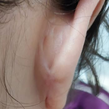 Özel Ekol Hastanesi (Edirne) Özel Hastanede Beklenmedik Olumsuz Deneyim