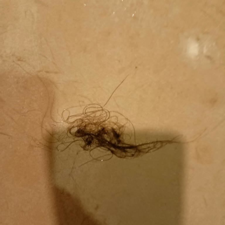 Alanya'da Hayal Kırıklığı: Sistematik Sorunlar Ve Güvensizlik