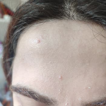 Bioderma Güneş Kremi Yüzümde Beyaz Pütürler Oluşturuyor