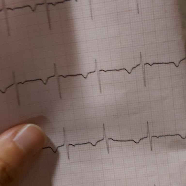 Hasta Haklarına Saygı Gösterilmemesi Ve Bilgilendirme Eksikliği