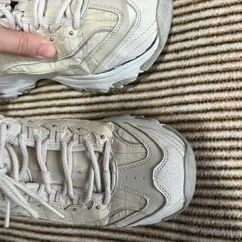 Skechers Ayakkabının Kısa Sürede Patlaması Şaşırtıcı