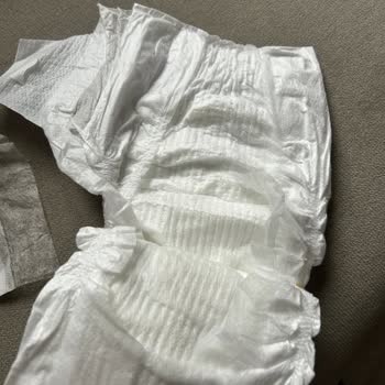 Molfix Bebek Bezlerinde Bant Eksikliği Ve İletişim Sorunu