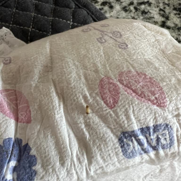 Bebek Bezinde Hijyen Sorunu