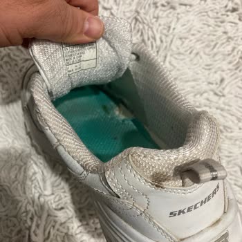 Skechers Ayakkabıda 6 Ayda Şaşırtıcı Aşınma