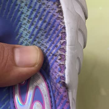 Boyner Skechers Çocuk Ayakkabısı 20 Günde Yırtıldı