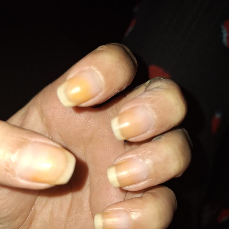 Flormar Ojesi Tırnakta Kalıcı Sararma Yaptı