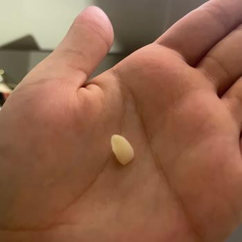 Diş Tedavisinde Hayal Kırıklığı Ve Maddi Mağduriyet