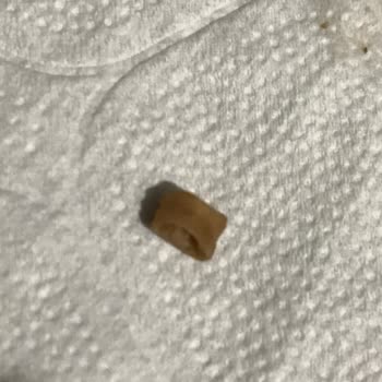 Metro Grossmarket İçli Köftede Beklenmedik Yabancı Madde Şoku!