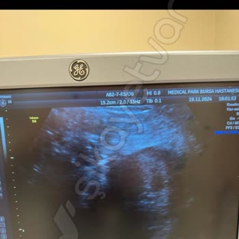 Özel Hastanede Kaba Davranış Ve Yetersiz Hizmet