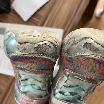 Skechers Ayakkabının Dayanıklılığı Hayal Kırıklığı Yarattı
