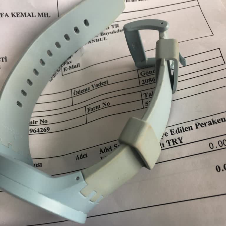 Swatch Refused to Replace My Watch Strap Despite Warranty and Quality Issues