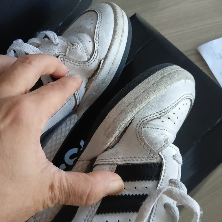 SuperStep Adidas Ayakkabıda Kısa Sürede Patlama Sorunu