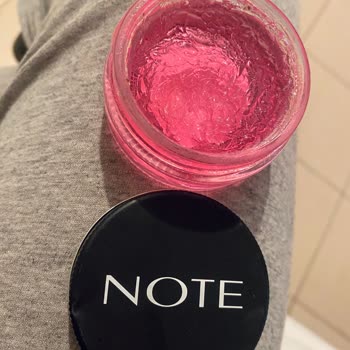 Kaş Sabitleyici Kullanımı Sonrası Ciddi Cilt Sorunları