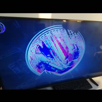 Televizyon Ekran Sorunları ve Müşteri Deneyimi