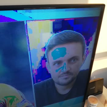 Televizyon Ekran Sorunları ve Müşteri Deneyimi