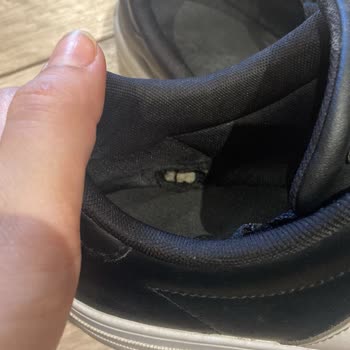 Adidas Ayakkabıda Beklenmedik Deformasyon Sorunu